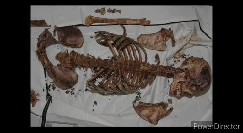 Them Bones (skeletonized dead bodies compilation) (reupload)