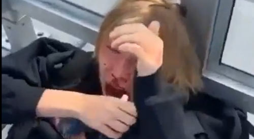 White Guy Violently Beaten For Literally Saying "N-Word"