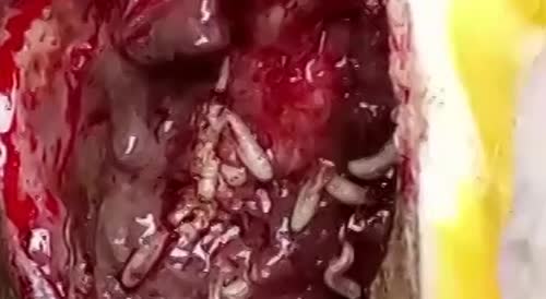 Infected leg infestation.