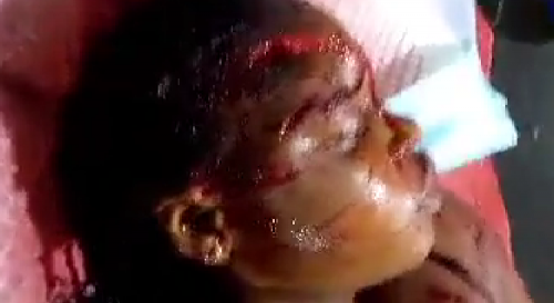 Betrayed Man Hacked Cheating Wife With Machete