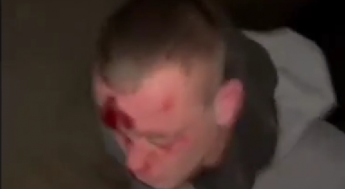 Caught Stealing Drugs For Sale In Russia