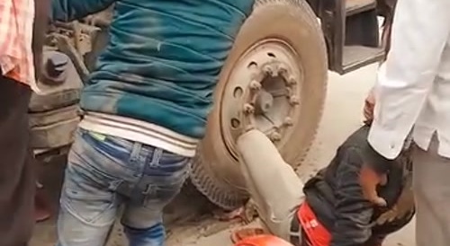 Leg got fucked up