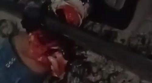 woman cut in half